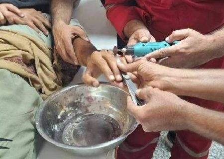 رهاسازی انگشتر از دست مصدوم در بیمارستان جاسک